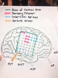 Electrode locations for thesis